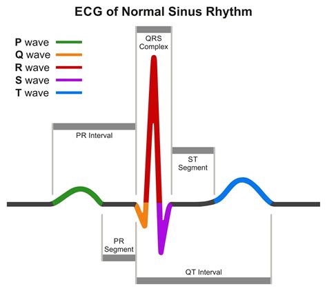 EKG & ECG Interpretation Explained | ACLS Certification Association