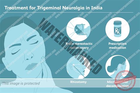 What is the Best Treatment for Trigeminal Neuralgia? - Boston Brain and Spine Care | Best ...