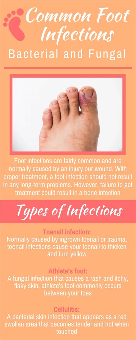 PPT - Common Foot Infections Bacterial and Fungal PowerPoint ...