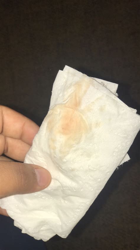 What Causes Light Blood When Wiping at Hunter Berry blog