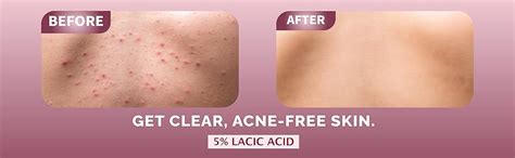 Buy Dermalist Exfoliating & Brightening Body Wash 5% Lactic Acid + 2% ...