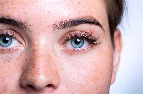 The Origin of Blue Eyes – Iris