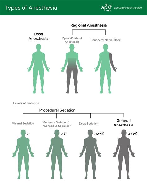 What are the Types of Anesthesia? - Anesthesia Patient Safety Foundation