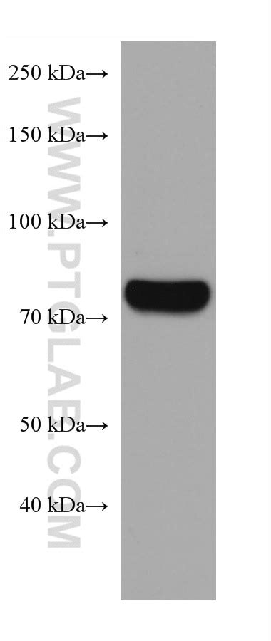 CARS antibody (67933-1-Ig) | Proteintech