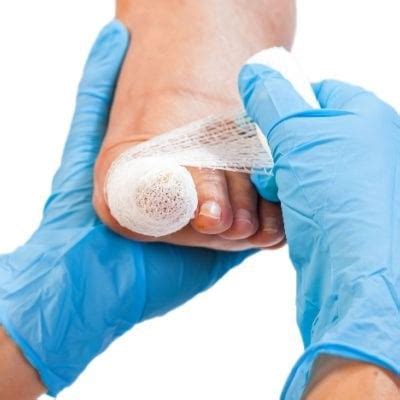 Image result for Toe Surgery