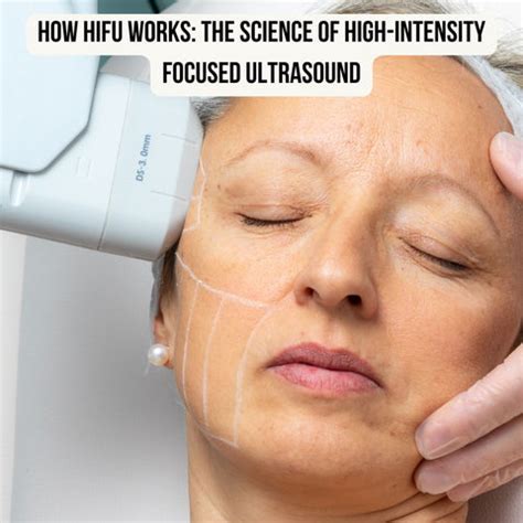 HIFU for Fat Reduction: The Non-Surgical Solution | Clinikally