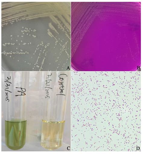 Isolation, Identification, and Drug Sensitivity Test of Pseudomonas ...