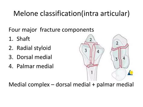 Image result for Open Reduction Distal Radius Fracture