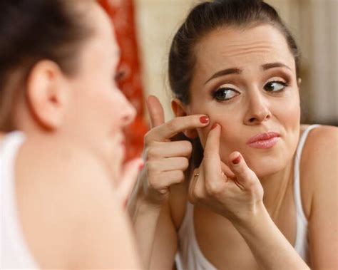 Get Rid of Zits that Pop just Before your Period | Femina.in