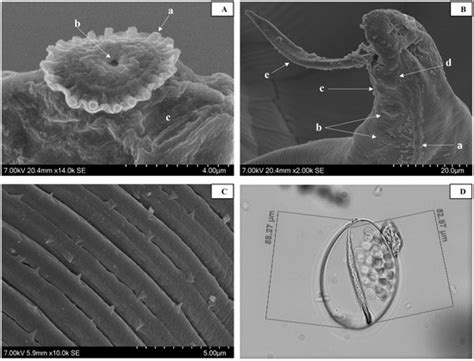 Development and Validation of Novel PCR Assays for the Diagnosis of ...