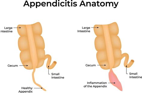 Image result for Appendix Example Website