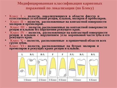Глубокий кариес зуба - симптомы, диагностика и лечение