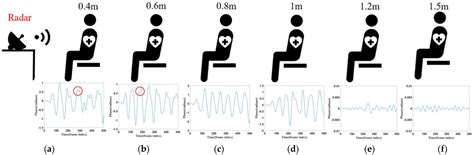 mmWave-RM: A Respiration Monitoring and Pattern Classification System ...