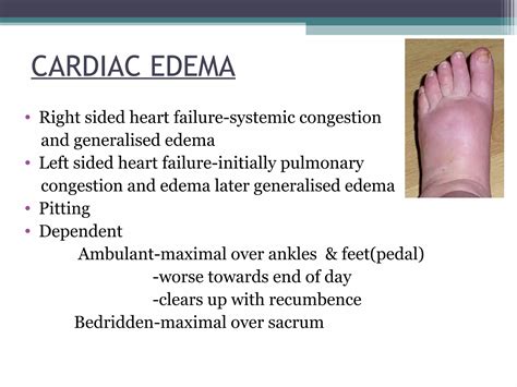 Pedal Edema Icd 10