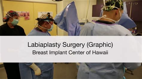 Dr Miami Labiaplasty
