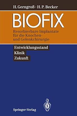 Buy BIOFIX: Resorbierbare Implantate für die Knochen- und ...