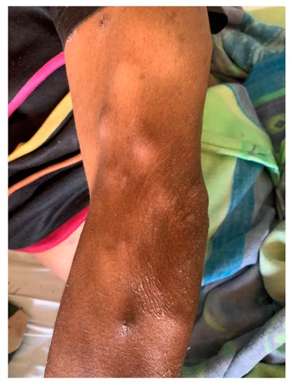 TropicalMed | February 2022 - Browse Articles