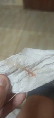 Flujo tipo moco | BabyCenter