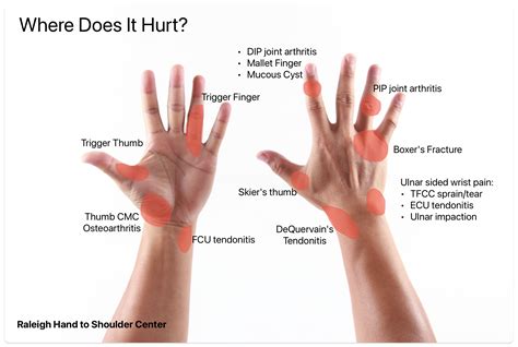 Wrist Pain Under Thumb