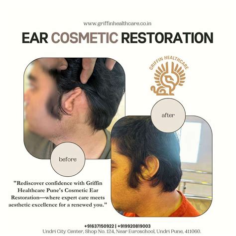 Prosthetic Service Pune| Artificial Limb Pune | Orthotics Pune