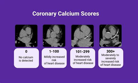 Coronary Calcium Score Near Me | LabFinder