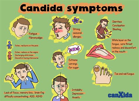 Signs & Symptoms of Candida | Candida symptoms, Candida overgrowth, Candida