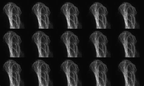 Image result for Super-Resolution Microscopy