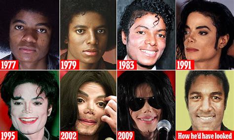 Mj Face Surgery