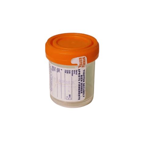 FetchDX Dog Urinalysis with Reflex Culture & Sensitivity Kit – Doobert