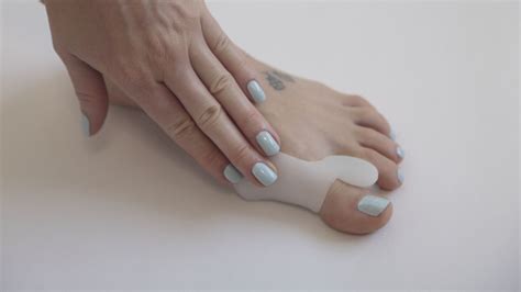 How To Prevent Bunion From Getting Worse: Can You Stop It?