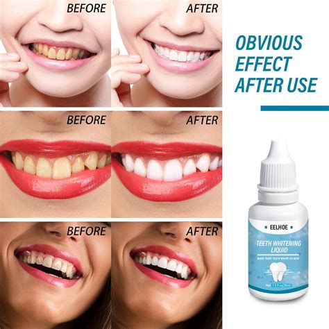 Buy Teeth Cleaning Teeth Liquid Oral Teeth Serum Liquid Whitening ...