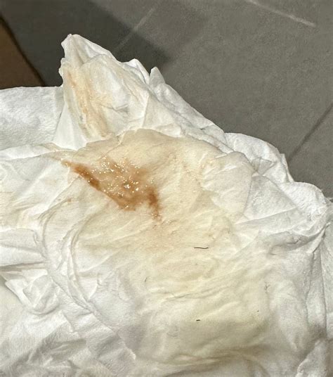 Implantation Bleeding And Mucus Periods V/S Pregnancy Bleeding