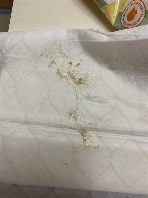 Coughing up phlegm with specks in it : r/Pulmonology