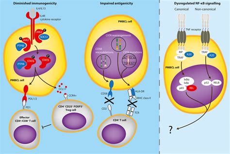 Primary Mediastinal B Cell Lymphoma