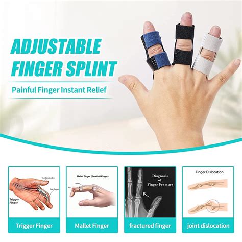 Image result for Adjustable Finger Splints