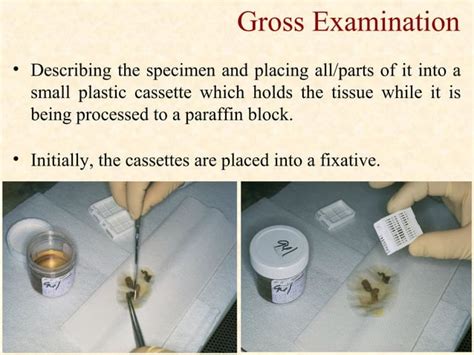 Image result for Process Germline Tissue Sample