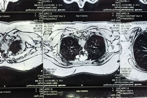 Image result for Computer Tomography Scanning
