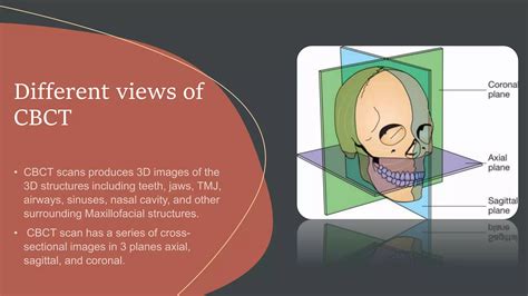 CBCT anatomical structures | PPTX