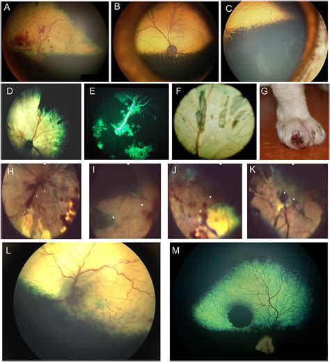 Frontiers | Manifestations of systemic disease in the retina and fundus ...
