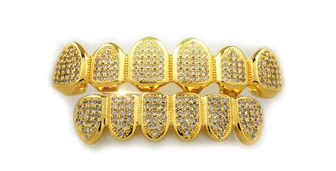 Gold is trending: the luxurious smile of celebrities!