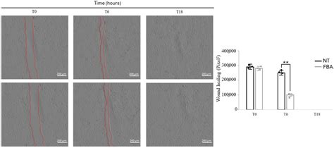 The Beneficial Effects of a N-(1-Carbamoyl-2-phenyl-ethyl) Butyramide ...