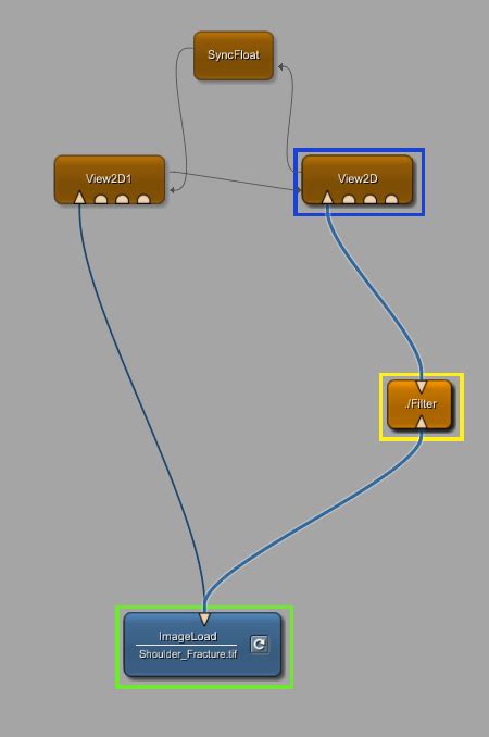 Image result for MeVisLab Connectors Triangle