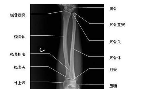 Image result for Difference in Difference Approach Example Diagram