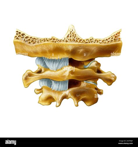 Atlanto-occipital joint. Artwork of the bones (yellow) and ligaments (blue) of the atlanto ...