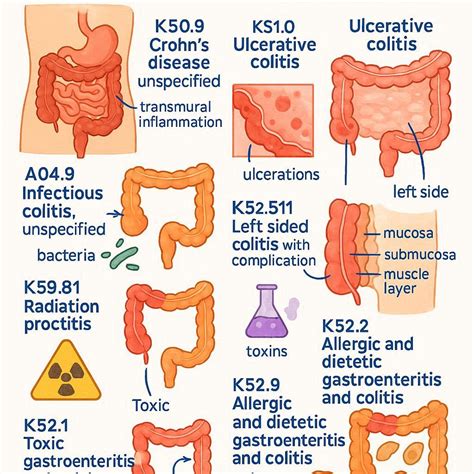 A Comprehensive Guide to ICD-10 Codes for Colitis - wmwtl