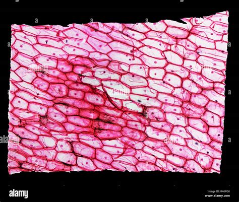 Onion Skin Cell