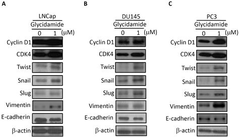 Glycidamide Promotes the Growth and Migratory Ability of Prostate ...