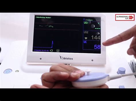 Fetal Monitor - Contec Fetal Monitor Trader - Wholesaler / Distributor ...