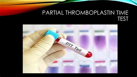 Clinical laboratory technology- partial thromboplastin time | PDF