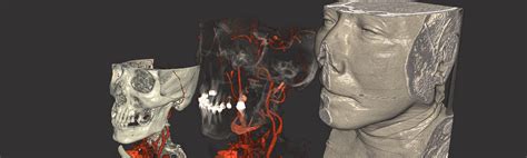 Image result for MeVisLab Connectors Triangle